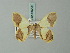  ( - BC ZSM Lep 69226)  @11 [ ] CreativeCommons - Attribution Non-Commercial Share-Alike (2015) Axel Hausmann/Bavarian State Collection of Zoology (ZSM) SNSB, Zoologische Staatssammlung Muenchen