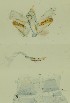  ( - BC ZSM Lep 89851)  @11 [ ] by-nc-sa (2023) SNSB, Staatliche Naturwissenschaftliche Sammlungen Bayerns ZSM (SNSB, Zoologische Staatssammlung Muenchen)