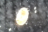  (Parthenolecanium pomeranicum - ZMBN_Coc36)  @11 [ ] copyright (2014) Bergen Museum Bergen Museum