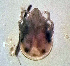  (Torrenticola eseni - CCDB_39399_A11)  @11 [ ] CreativeCommons - Attribution Share-Alike (2023) Unspecified University of Montenegro, Faculty of Sciences and Mathematics, Department of Biology, Podgorica
