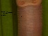  ( - EW-Z3-215)  @11 [ ] Unspecified (default): All Rights Reserved (2015) Shweta Yadav Dr Harisingh Gour Vishwavidyalaya,Sagar MP,India