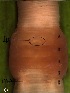  (Eudichogaster mullani - 16M)  @11 [ ] Department of Zoology, Doctor Harisingh Gour University, Sagar (2015) Satendra Tomar Department of Zoology, Doctor Harisingh Gour University, Sagar