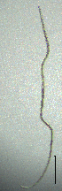  (Longidorus fagi - BGE_00645_D03)  @11 [ ] CreativeCommons - Attribution Share - Alike (2025) Unspecified Unspecified