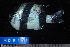  ( - NBE0188)  @13 [ ] No Rights Reserved  Unspecified Unspecified