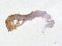  ( - BIOUG06971-F11)  @13 [ ] CreativeCommons - Attribution (2013) Trevor Bringloe Centre for Biodiversity Genomics