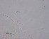  ( - 100914-3-11)  @11 [ ] CreativeCommons - Attribution Non-Commercial Share-Alike (2017) Unspecified Norwegian Veterinary Institute