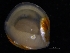  ( - ZMBN_125181)  @11 [ ] CreativeCommons - Attribution Non-Commercial Share-Alike (2018) University of Bergen Natural History Collections