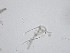 ( - M24NMF0002D1a_NMF147_Culture)  @11 [ ] by-sa (2025) Norwegian marine fungi UiT The Arctic University of Norway