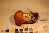  (Leccinum duriusculum - TROM-F-17504)  @11 [ ] CreativeCommons - Attribution Non-Commercial Share-Alike (2017) Unspecified Tromsø University Museum