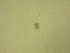  (Polyarthra dolichoptera - NZPL378)  @11 [ ] Copyright (2010) Unspecified Department of Biological Sciences, University of Waikato