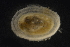  (Neolepetopsidae - PES17ISS2GP12b)  @11 [ ] CreativeCommons  Attribution (by) (2018) Unspecified Woods Hole Oceanographic Institution