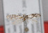  (Argyresthia friulii - TLMF Lep 04276)  @11 [ ] CreativeCommons - Attribution Non-Commercial Share-Alike (2011) Peter Huemer Tiroler Landesmuseum Ferdinandeum