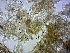  ( - BC159)  @11 [ ] CreativeCommons - Attribution Non-Commercial Share-Alike (2018) S. L. Moya Instituto Nacional de Medicina Tropical