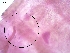  ( - BC184)  @11 [ ] CreativeCommons - Attribution Non-Commercial Share-Alike (2018) S. L. Moya Instituto Nacional de Medicina Tropical