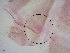  ( - BC200)  @11 [ ] CreativeCommons - Attribution Non-Commercial Share-Alike (2018) S. L. Moya Instituto Nacional de Medicina Tropical