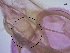  ( - BC212)  @11 [ ] CreativeCommons - Attribution Non-Commercial Share-Alike (2018) S. L. Moya Instituto Nacional de Medicina Tropical