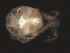  (Tiphys sp0956A - CNC-IMS090056.011)  @12 [ ] CreativeCommons - Attribution (2010) Unspecified Centre for Biodiversity Genomics