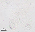  (Krenopelopia sp. 2XL - sun400)  @11 [ ] CreativeCommons - Attribution Non-Commercial Share-Alike (2020) Xiaolong Lin College of Life Sciences, Nankai Unviersity