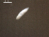  (Posthodiplostomum sp. 8 - P.LV.S08.Md.3F.2)  @13 [ ] Copyright (2010) Unspecified Environment Canada