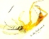  (cryptJanzen01 Malaise2368 - IAvH-TRI-MAL238-HYM-0344.5)  @11 [ ] Copyright (2023) Instituto de Investigacion Alexander von Humboldt (IAvH) Instituto de Investigacion Alexander von Humboldt (IAvH)