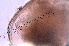  (Chydorus sp - ZPJW36)  @11 [ ] Copyright (2015) PHCDBS PAUL HEBERT CENTRE FOR DNA BARCODING AND BIODIVERSITY STUDIES